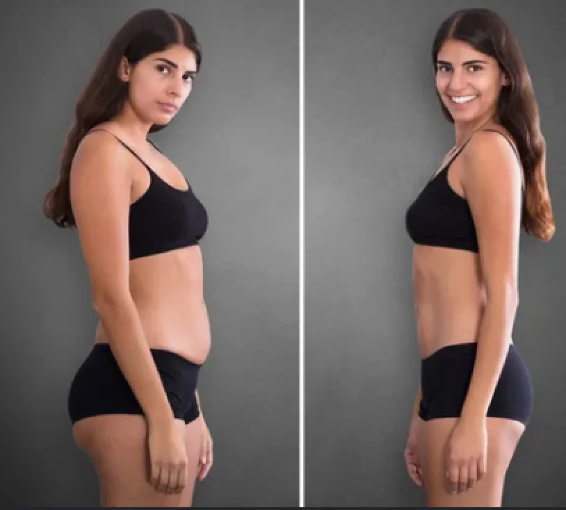 MERVE Transformation